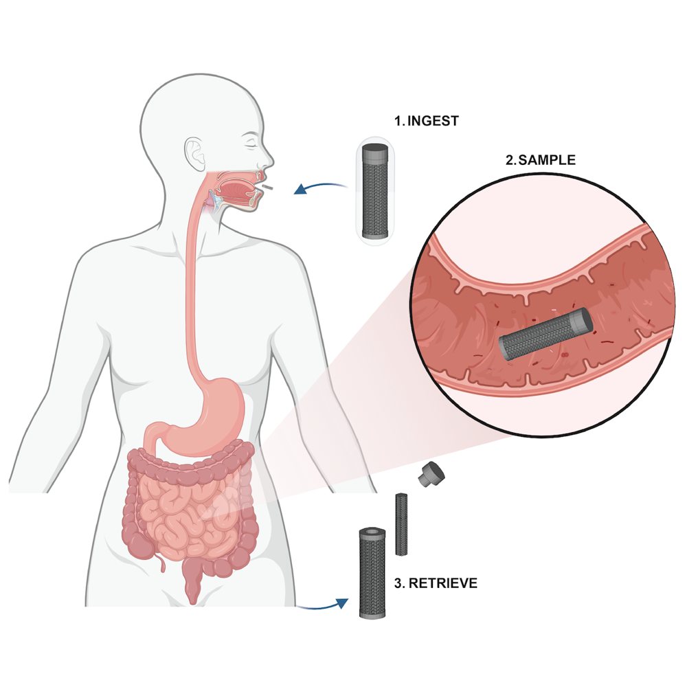 Illustration: the capsule is swallowed, samples bacteria in the small intestine, and is retrieved after it exits the body